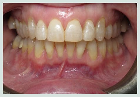 Orthodontics, after
