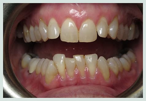 Orthodontics, before