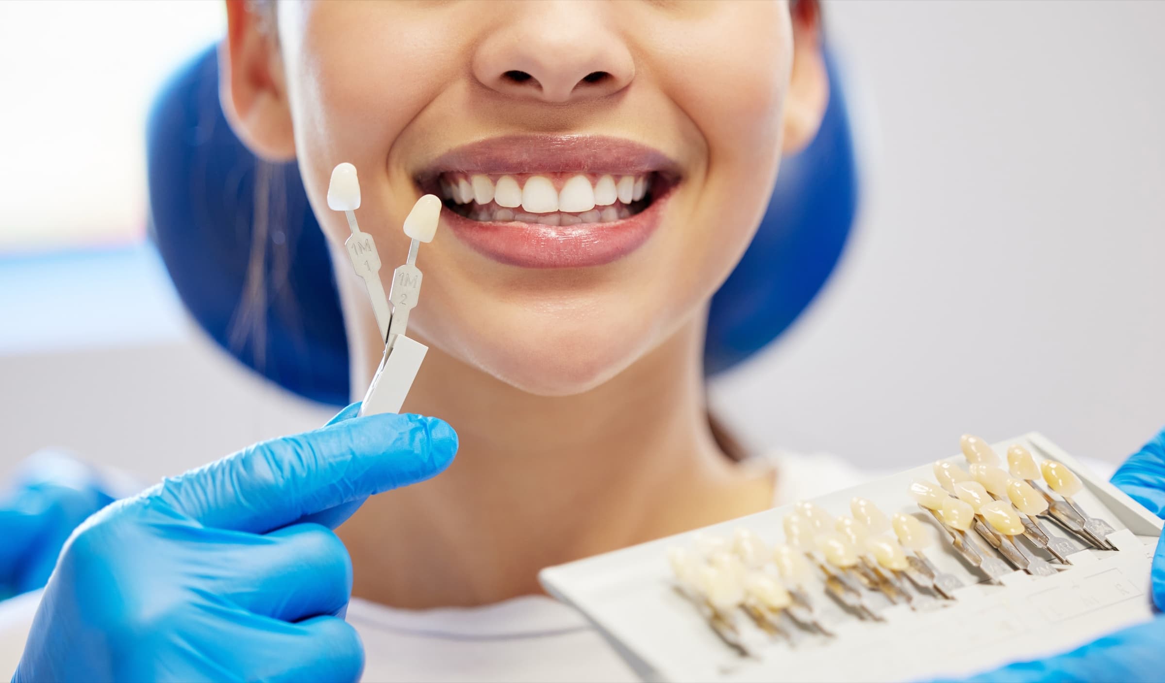 A dental shade guide held next to brightened teeth