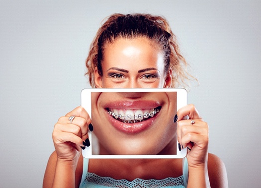 A young woman holding a tablet in front of her face and smiling to show off her braces in Uptown New Orleans