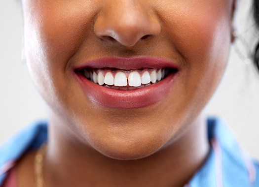 A woman’s smile that shows a gap between her two front teeth