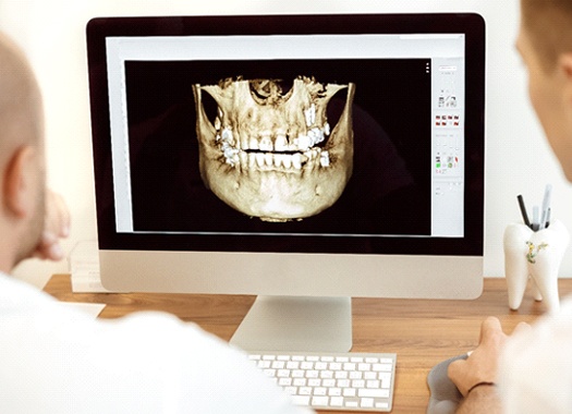 a dentist and a dental assistant looking at a digital cone beam CT image on a desktop computer
