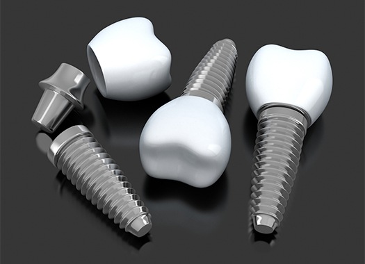 three dental implants with abutments and crowns