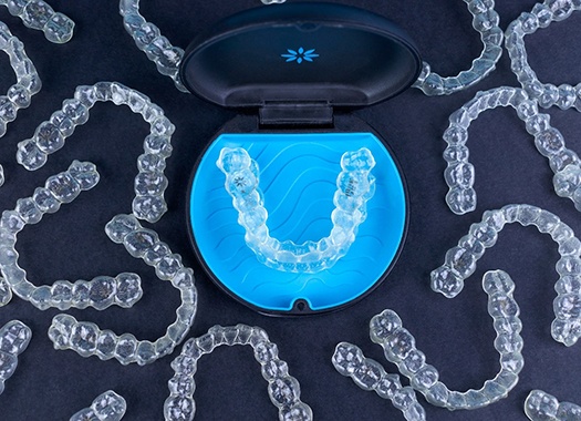 Clear aligner resting in tray next to several other clear aligners