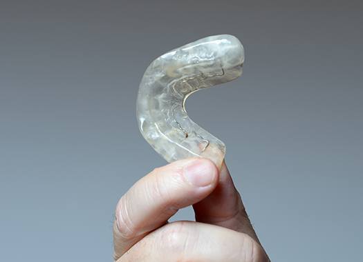 Clear occlusal splint for TMJ therapy