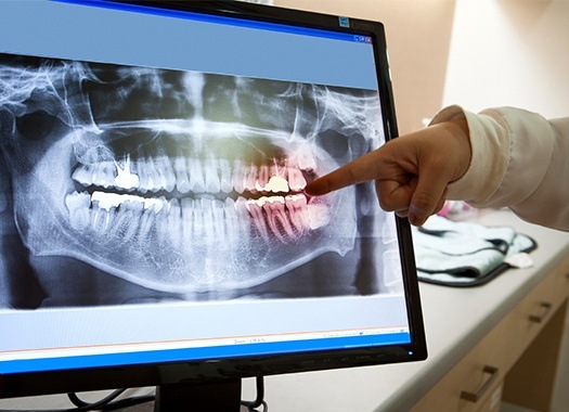 Digital x-rays on computer screen