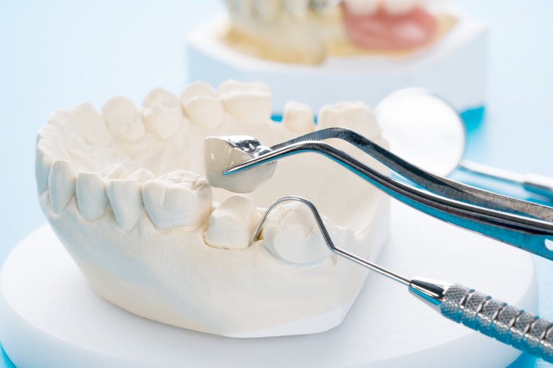 A model used to fit dental crowns